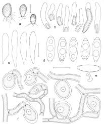 Attēlu rezultāti vaicājumam “Octosporella jungermanniarum”