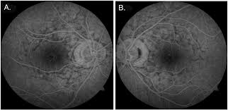 Attēlu rezultāti vaicājumam “Reticularia jurana young”