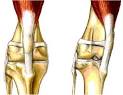 Chinaroad Lowchens of Australia - Medially luxating patella