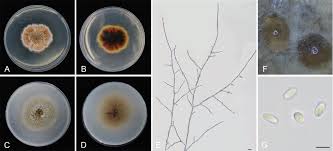 Attēlu rezultāti vaicājumam “Diderma testaceum spores”