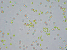 Attēlu rezultāti vaicājumam “Pleurococcus vulgaris”