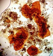 Attēlu rezultāti vaicājumam “Licea minima spores”