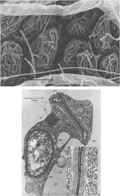 Attēlu rezultāti vaicājumam “Physarum straminipes young”