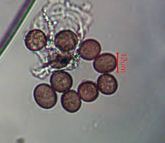 Attēlu rezultāti vaicājumam “Badhamia macrocarpa macro”