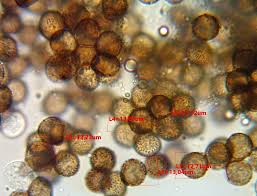 Attēlu rezultāti vaicājumam “Badhamia capsulifera var. arborea macro”