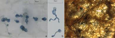 Attēlu rezultāti vaicājumam “Trichia botrytis spores”