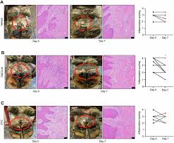Attēlu rezultāti vaicājumam “Diderma simplex macro”