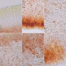 Attēlu rezultāti vaicājumam “Chlorencoelia versiformis”