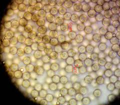 Attēlu rezultāti vaicājumam “Stemonitopsis hyperopta var. landewaldii spores”