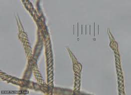 Attēlu rezultāti vaicājumam “Trichia contorta macro”