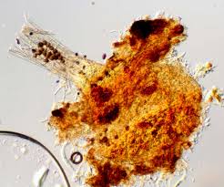 Attēlu rezultāti vaicājumam “Melanospora lagenaria”