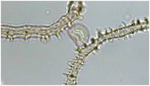 Attēlu rezultāti vaicājumam “Arcyria affinis spores”