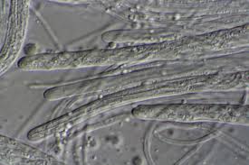 Attēlu rezultāti vaicājumam “Stictis”