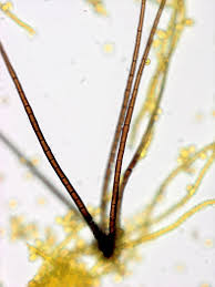 Attēlu rezultāti vaicājumam “Trichia scabra spores”