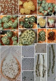 Attēlu rezultāti vaicājumam “Arcyria globosa young”