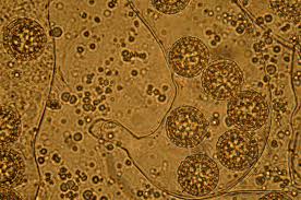 Attēlu rezultāti vaicājumam “Pachyphloeus melanoxanthus”