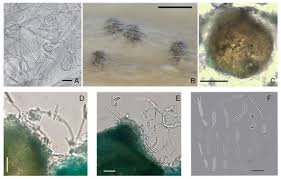 Attēlu rezultāti vaicājumam “Dianema nivale spores”