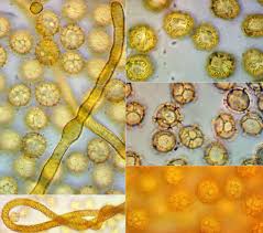 Attēlu rezultāti vaicājumam “Oligonema persimile spores”