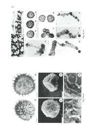Attēlu rezultāti vaicājumam “Fossombronia wondraczekii”