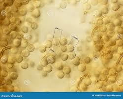 Attēlu rezultāti vaicājumam “Physarum luteolum spores”