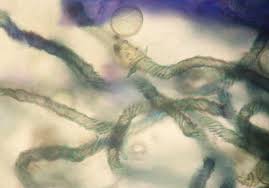 Attēlu rezultāti vaicājumam “Hemitrichia sordivesiculosa spores”