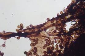 Attēlu rezultāti vaicājumam “Amaurochaete atra macro”