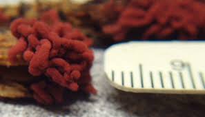 Attēlu rezultāti vaicājumam “Arcyria denudata spores”