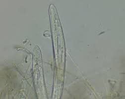 Attēlu rezultāti vaicājumam “Neocudoniella albiceps”