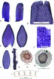 Attēlu rezultāti vaicājumam “Sphagnum angustifolium sporophyte”