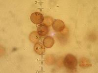 Attēlu rezultāti vaicājumam “Badhamiopsis macrospora”