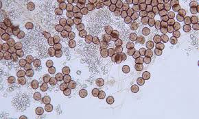 Attēlu rezultāti vaicājumam “Didymium squamulosum spores”