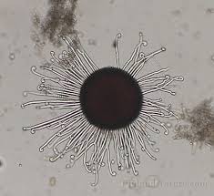 Attēlu rezultāti vaicājumam “Sawadaea tulasnei”