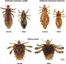 Attēlu rezultāti vaicājumam “Pediculus humanus capitis”