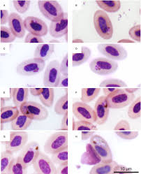 Attēlu rezultāti vaicājumam “undetermined plasmodium”