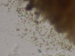 Attēlu rezultāti vaicājumam “Chaenotheca gracilenta”