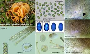 Attēlu rezultāti vaicājumam “Sowerbyella radiculata”
