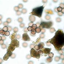 Attēlu rezultāti vaicājumam “Stemonitopsis aequalis var. microspora spores”