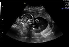 Image result for baby girl an...Gb5PHZRxQS2C_M: