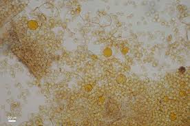 Attēlu rezultāti vaicājumam “Hemitrichia sordivesiculosa”