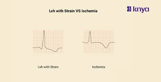 Image result for  ^ L V [ h    