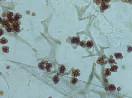 Attēlu rezultāti vaicājumam “Badhamia foliicola”