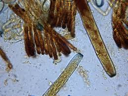 Attēlu rezultāti vaicājumam “Peziza flavida”