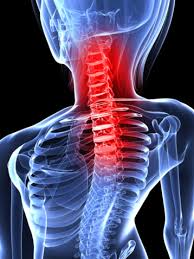 Osteoporosis