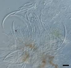 Attēlu rezultāti vaicājumam “Physconia distorta”