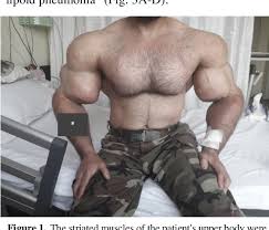Image result for SYNTHOL