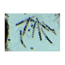 Attēlu rezultāti vaicājumam “Sordaria fimicola”