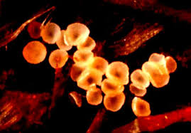 Attēlu rezultāti vaicājumam “Licea chelonoides spores”