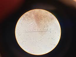 Attēlu rezultāti vaicājumam “Diachea leucopodia young”