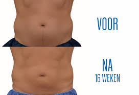 Image result for manboobs