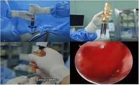 Image result for BMAC